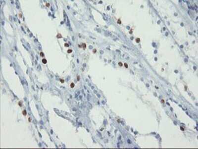 Immunohistochemistry: FOXI1 Antibody (OTI1D4) - Azide and BSA Free [NBP2-70747] - Staining of paraffin-embedded Human Kidney tissue using anti-FOXI1 mouse monoclonal antibody.