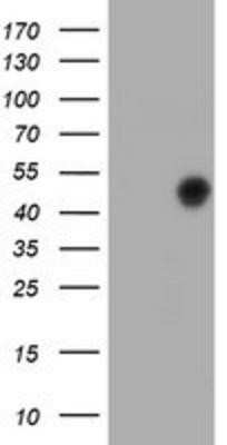 Western Blot: FOXI1 Antibody (OTI1D4) - Azide and BSA Free [NBP2-70747] - HEK293T cells were transfected with the pCMV6-ENTRY control (Left lane) or pCMV6-ENTRY FOXI1 (Right lane) cDNA for 48 hrs and lysed. Equivalent amounts of cell lysates (5 ug per lane) were separated by SDS-PAGE and immunoblotted with anti-FOXI1.