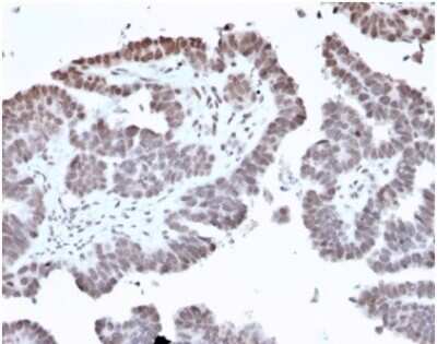 Immunohistochemistry-Paraffin: FOXI1 Antibody (PCRP-FOXL1-1F8) [NBP3-13886] - Formalin-fixed, paraffin-embedded human prostate stained. FOXI1 antibody (PCRP-FOXL1-1F8) at 2ug/ml. HIER: Tris/EDTA, pH9.0, 45min. HRP-polymer, 30min. DAB, 5min.