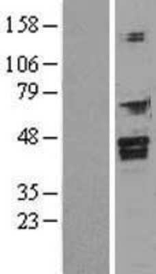 Western Blot: FOXI1 Overexpression Lysate (Adult Normal) [NBL1-10805] Left-Empty vector transfected control cell lysate (HEK293 cell lysate); Right -Over-expression Lysate for FOXI1.