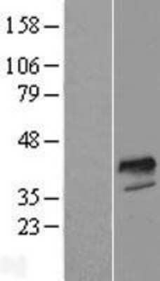 Western Blot: FOXI1 Overexpression Lysate (Adult Normal) [NBP2-05518] Left-Empty vector transfected control cell lysate (HEK293 cell lysate); Right -Over-expression Lysate for FOXI1.