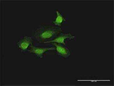 Immunocytochemistry/Immunofluorescence: FOXJ2 Antibody [H00055810-D01P] - Analysis of antibody to FOXJ2 on HeLa cell. Antibody concentration 10 ug/ml.