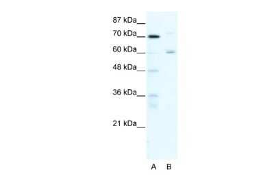 Western Blot: FOXJ2 Antibody [NBP2-87470] - WB Suggested Anti-FOXJ2 Antibody Titration: 0.25ug/ml. Positive Control: HepG2 cell lysate