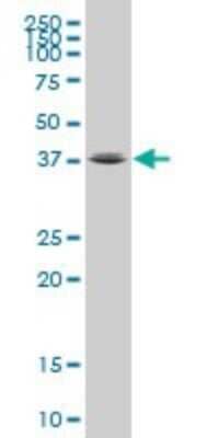 Western Blot: FOXL1 Antibody (1A7) [H00002300-M03] - Analysis of FOXL1 expression in Daoy.