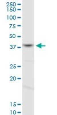 Western Blot: FOXL1 Antibody [H00002300-D01P] - Analysis of FOXL1 expression in HL-60.