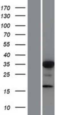 Western Blot FOXL1 Overexpression Lysate