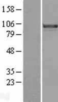 Western Blot FoxM1 Overexpression Lysate