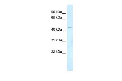 Western Blot FOXN2 Antibody - BSA Free