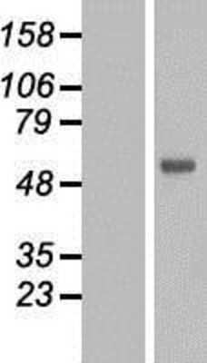 Western Blot FOXN2 Overexpression Lysate