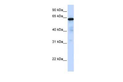 Western Blot FOXN4 Antibody