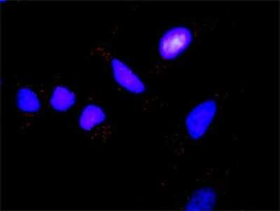 Proximity Ligation Assay: FOXO3 Antibody (1B11) [H00002309-M02] - Analysis of protein-protein interactions between IKBKB and FOXO3. HeLa cells were stained with anti-IKBKB rabbit purified polyclonal 1:1200 and anti-FOXO3 mouse monoclonal antibody 1:50. Each red dot represents the detection of protein-protein interaction complex, and nuclei were counterstained with DAPI (blue).