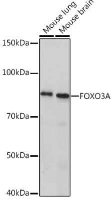 Western Blot: FOXO3 Antibody (8B9X5) [NBP3-16801] - Western blot analysis of extracts of various cell lines, using FOXO3 Rabbit mAb (NBP3-16801) at 1:1000 dilution. Secondary antibody: HRP Goat Anti-Rabbit IgG (H+L) at 1:10000 dilution. Lysates/proteins: 25ug per lane. Blocking buffer: 3% nonfat dry milk in TBST. Detection: ECL Enhanced Kit. Exposure time: 3min.