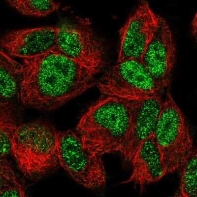Immunocytochemistry/Immunofluorescence: FOXO3 Antibody [NBP2-55691] - Staining of human cell line SH-SY5Y shows localization to nucleoplasm.