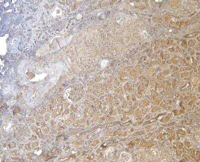 Immunohistochemistry: FOXO3 Antibody [NB100-1438] - (5ug/ml) staining of paraffin embedded Human Kidney. Heat induced antigen retrieval with citrate buffer pH 6, HRP-staining.