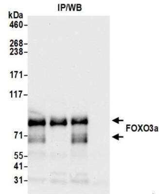Immunoprecipitation: FOXO3 Antibody [NBP3-14720] - Whole cell lysate (1.0 mgper IP reaction; 20% of IP loaded) from Jurkat cells preparedusing NETN lysis buffer. Antibodies: Rabbit anti-FOXO3arecombinant monoclonal antibody used for IP at 20 ul/mg lysate. FOXO3a was alsoimmunoprecipitated by rabbit anti-FOXO3a antibodies For blottingimmunoprecipitated FOXO3a, was used at1:1000. Chemiluminescence with an exposure time of 10seconds.