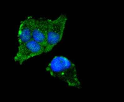 Immunocytochemistry/Immunofluorescence: FOXO3 Antibody (SP0054) [NBP2-66852] - Staining FOXO3A in Hela cells (green). The nuclear counter stain is DAPI (blue). Cells were fixed in paraformaldehyde, permeabilised with 0.25% Triton X100/PBS.