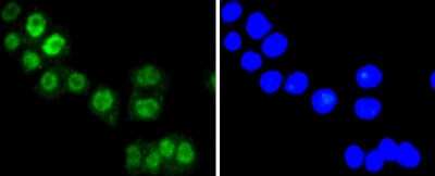 Immunocytochemistry/Immunofluorescence: FOXO3 Antibody (SP0054) [NBP2-66852] - Staining FOXO3A in SW480 cells (green). The nuclear counter stain is DAPI (blue). Cells were fixed in paraformaldehyde, permeabilised with 0.25% Triton X100/PBS.