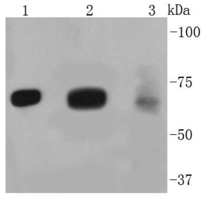 Western Blot: FOXO3 Antibody (SP0054) [NBP2-66852] - Analysis of FOXO3A on different lysates using anti- FOXO3A antibody at 1/1,000 dilution. Positive control: Lane 1: NIH/3T3 Lane 2: PC-12 Lane 3: MCF-7