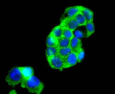 Immunocytochemistry/Immunofluorescence: FOXO4 Antibody (JJ09-11) [NBP2-67892] - Staining FOXO4 in 293T cells (green). The nuclear counter stain is DAPI (blue). Cells were fixed in paraformaldehyde, permeabilised with 0.25% Triton X100/PBS.