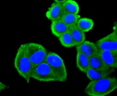 Immunocytochemistry/Immunofluorescence: FOXO4 Antibody (JJ09-11) [NBP2-67892] - Staining FOXO4 in Hela cells (green). The nuclear counter stain is DAPI (blue). Cells were fixed in paraformaldehyde, permeabilised with 0.25% Triton X100/PBS.