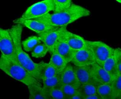 Immunocytochemistry/Immunofluorescence: FOXO4 Antibody (JJ09-11) [NBP2-67892] - Staining FOXO4 in HepG2 cells (green). The nuclear counter stain is DAPI (blue). Cells were fixed in paraformaldehyde, permeabilised with 0.25% Triton X100/PBS.