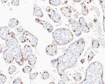 Immunohistochemistry-Paraffin: FOXO4 Antibody (JJ09-11) [NBP2-67892] - Immunohistochemical analysis of paraffin-embedded human placenta tissue using anti-FOXO4 antibody. The section was pre-treated using heat mediated antigen retrieval with sodium citrate buffer (pH 6.0) for 20 minutes. The tissues were blocked in 5% BSA for 30 minutes at room temperature, washed with ddH2O and PBS, and then probed with the primary antibody (1/50) for 30 minutes at room temperature. The detection was performed using an HRP conjugated compact polymer system. DAB was used as the chromogen. Tissues were counterstained with hematoxylin and mounted with DPX.