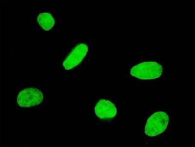 Immunocytochemistry/Immunofluorescence: FOXQ1 Antibody (2F2) [H00094234-M05] - Analysis of monoclonal antibody to FOXQ1 on HeLa cell. Antibody concentration 10 ug/ml