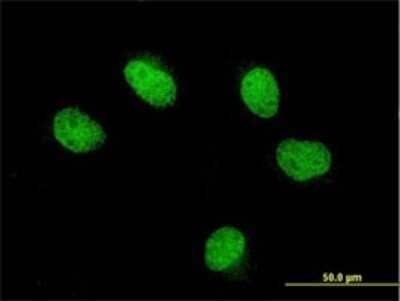 Immunocytochemistry/Immunofluorescence: FOXQ1 Antibody (4H8) [H00094234-M07] - Analysis of monoclonal antibody to FOXQ1 on HeLa cell. Antibody concentration 10 ug/ml