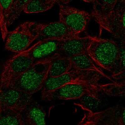 Immunocytochemistry/Immunofluorescence: FOXQ1 Antibody [NBP2-56026] - Staining of human cell line Hep G2 shows localization to nucleus. Antibody staining is shown in green.