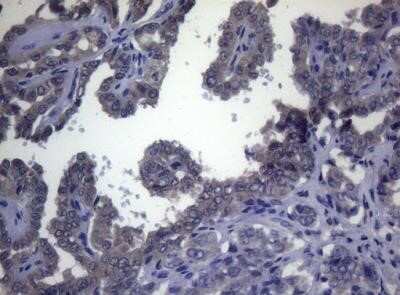 Immunohistochemistry FOXQ1 Antibody (OTI4D9) - Azide and BSA Free