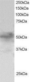 Western Blot: FOXQ1 Antibody [NB100-1283] - (1ug/ml) of H460 lysate (RIPA buffer, 30ug total protein per lane). Primary incubated for 1 hour. Detected by western blot using chemiluminescence.