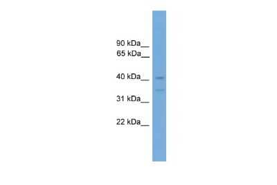 Western Blot: FOXQ1 Antibody [NBP3-10403] - Western blot analysis of FOXQ1 in Mouse Brain as a positive control. Antibody dilution at 0.2-1 ug/ml