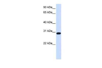 Western Blot: FOXR1 Antibody [NBP3-09247] - Western blot analysis using NBP3-09247 on Human Heart  as a positive control. Antibody Titration: 0.2-1 ug/ml