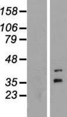 Western Blot: FOXR1 Overexpression Lysate (Adult Normal) [NBL1-10820] Left-Empty vector transfected control cell lysate (HEK293 cell lysate); Right -Over-expression Lysate for FOXR1.