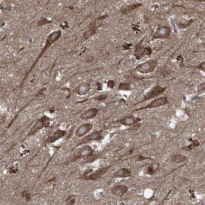 Immunohistochemistry FOXRED2 Antibody - BSA Free