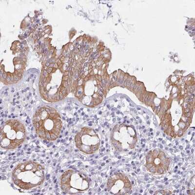 Immunohistochemistry: FPGS Antibody [NBP2-48965] - Staining of human rectum shows distinct cytoplasmic and membranous positivity in glandular cells.