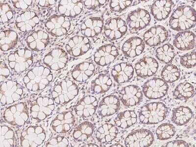 Immunohistochemistry: FPGS Antibody [NBP3-06209] - Immunochemical staining of human FPGS in human kidney with rabbit polyclonal antibody at 1:500 dilution, formalin-fixed paraffin embedded sections.