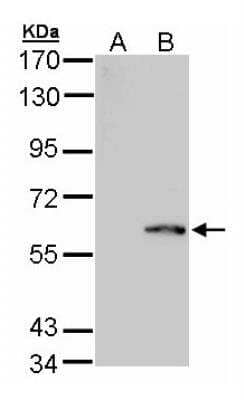 Western Blot: FPGS Antibody [NBP2-16526] - Analysis of FPGS expression in transfected 293T cell line by FPGS polyclonal antibody. A: Non-transfected lysate. B: FPGS transfected lysate. 7. 5% SDS PAGE gel, diluted at 1:1000.