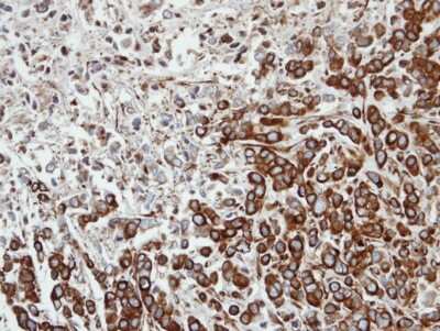 Immunohistochemistry-Paraffin: FPGT Antibody [NBP1-31436] - Paraffin-embedded MDA-MB-468 xenograft, using antibody at 1:100 dilution.