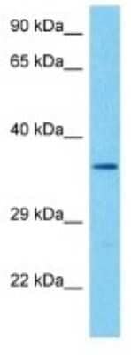 Western Blot: FPR-RS7 Antibody [NBP3-10207] - Western blot analysis of FPR-RS7 in Mouse Small Intestine lysates. Antibody dilution at 1ug/ml