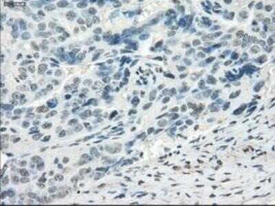 Immunohistochemistry: FRA-1/FOSL1 Antibody (OTI12F9) - Azide and BSA Free [NBP2-71351] - Staining of paraffin-embedded Kidney tissue using anti-FOSL1 mouse monoclonal antibody.