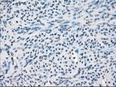 Immunohistochemistry: FRA-1/FOSL1 Antibody (OTI12F9) - Azide and BSA Free [NBP2-71351] - Staining of paraffin-embedded Ovary tissue using anti-FOSL1 mouse monoclonal antibody.