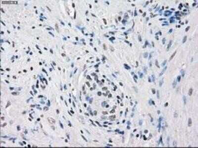 Immunohistochemistry: FRA-1/FOSL1 Antibody (OTI12F9) - Azide and BSA Free [NBP2-71351] - Staining of paraffin-embedded prostate tissue using anti-FOSL1 mouse monoclonal antibody.