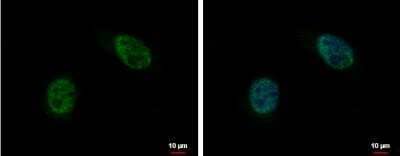 Immunocytochemistry/Immunofluorescence: FRA10AC1 Antibody [NBP2-16528] - HeLa cells were fixed in 4% paraformaldehyde at RT for 15 min. Green: C10orf4 protein stained by C10orf4 antibody  diluted at 1:500. Blue: Hoechst 33342 staining. Scale bar = 10 um.