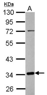 Western Blot: FRA10AC1 Antibody [NBP2-16528] - Sample (30 ug of whole cell lysate) A: HeLa nucleus 10% SDS PAGE gel, diluted at 1:1000.