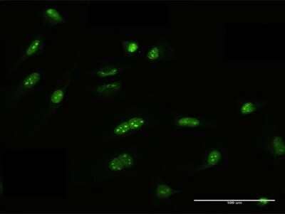 Immunocytochemistry/Immunofluorescence: FRG1 Antibody [H00002483-B01P] - Analysis of purified antibody to FRG1 on HeLa cell. (antibody concentration 10 ug/ml)