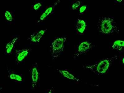 Immunocytochemistry/Immunofluorescence: FRG1 Antibody [NBP2-99204] - Immunofluorescence staining of FRG1 in HeLa cells. Cells were fixed with 4% PFA, permeabilzed with 0.3% Triton X-100 in PBS, blocked with 10% serum, and incubated with rabbit anti-human FRG1 polyclonal antibody (dilution ratio 1:1000) at 4C overnight. Then cells were stained with the Alexa Fluor(R)488-conjugated Goat Anti-rabbit IgG Secondary antibody (green).Positive staining was localized to nucleus.