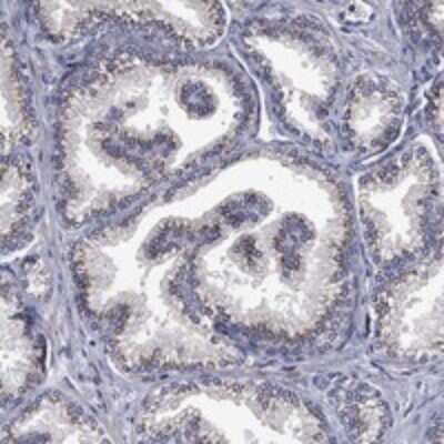 Immunohistochemistry-Paraffin: FRG1 Antibody [NBP3-17715] - Staining of human prostate shows strong cytoplasmic positivity in glandular cells.