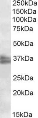 Western Blot: FRG1 Antibody [NBP1-49864] (2ug/ml) staining of Jurkat nuclear lysate (35ug protein in RIPA buffer). Primary incubation was 1 hour. Detected by chemiluminescence.