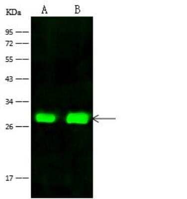 Western Blot: FRG1 Antibody [NBP2-99204] - Lane A: HeLa Whole Cell LysateLane B: Jurkat Whole Cell LysateLysates/proteins at 30 ug per lane.SecondaryGoat Anti-Rabbit  IgG (H&L) /Dylight 800  at 1/10000 dilution.Developed using the Odyssey technique.Performed under reducing conditions.Predicted band size:29 kDaObserved band size:29 kDa